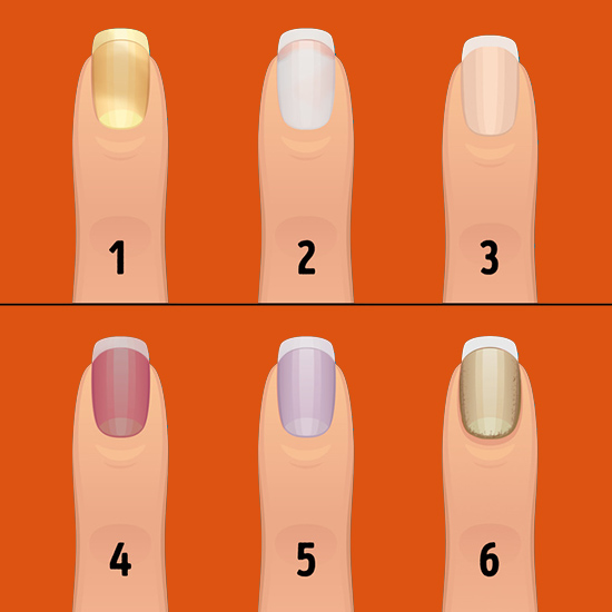 Nail Disorders and Diseases Sign in Colors